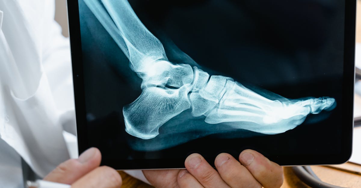 découvrez les solutions chirurgicales efficaces pour traiter l'hyperhidrose, une condition qui provoque une transpiration excessive. notre équipe d'experts vous accompagne tout au long du processus, des consultations préopératoires à la récupération, afin de vous aider à retrouver confort et confiance en vous.