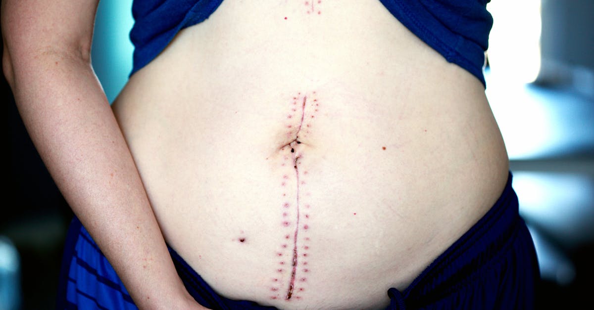découvrez l'univers de la chirurgie : techniques avancées, spécialités et innovations médicales. informez-vous sur les procédures, les soins post-opératoires et l'importance de la préparation pour une intervention réussie.