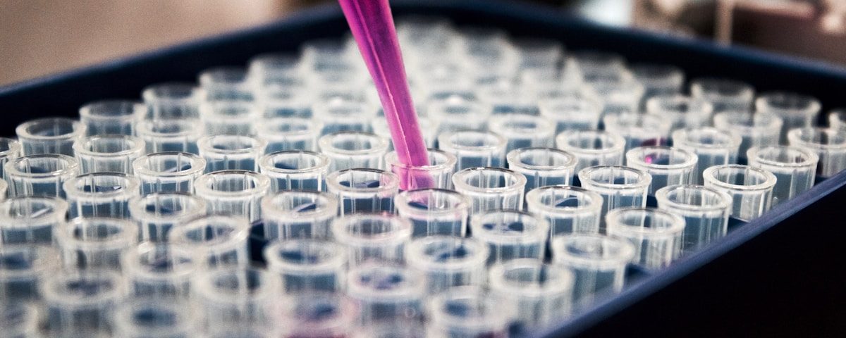 Iontophorèse : traitement de l&rsquo;hyperhidrose palmaire et plantaire
